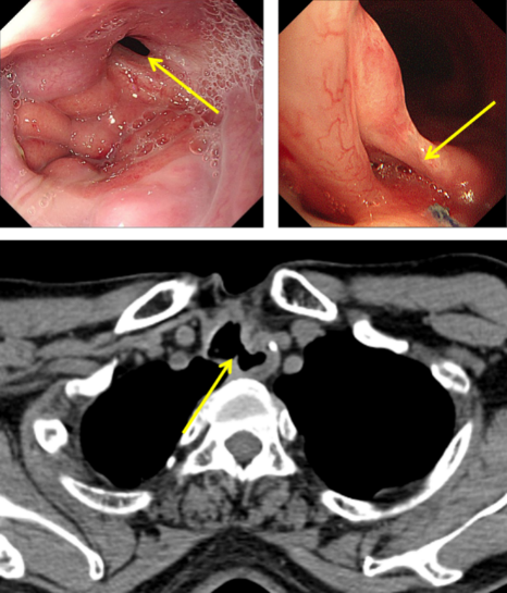 from clipboard from clipboard
